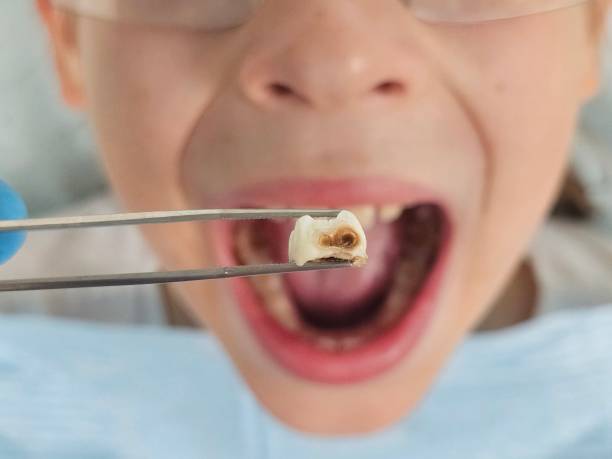 Best Cosmetic Emergency Dentistry in Tenino, WA